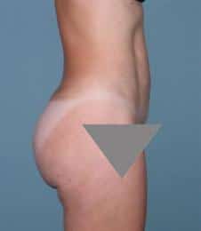 After Image