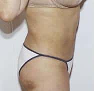 After Image