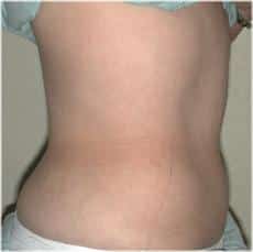 After Image