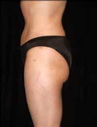 After Image