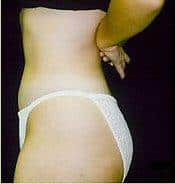 After Image