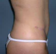After Image