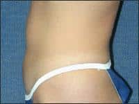 After Image