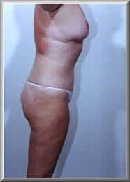After Image