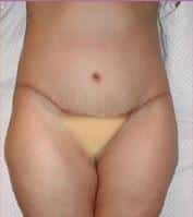 After Image