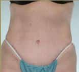 After Image