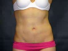 After Image