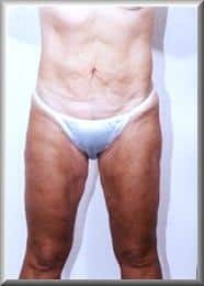 After Image