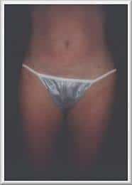 After Image
