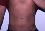 After Image
