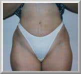 After Image