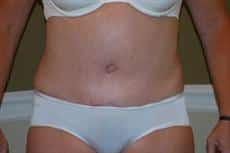 After Image
