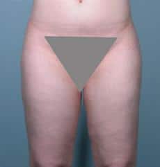 After Image