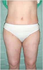 After Image