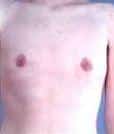After Image