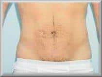 After Image