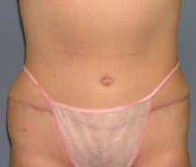 After Image