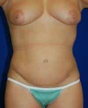 After Image