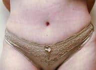After Image