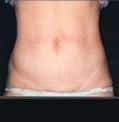 After Image