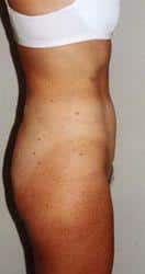 After Image