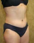 After Image