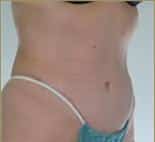 After Image