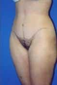 After Image