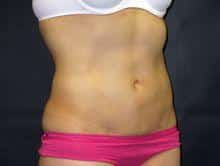 After Image