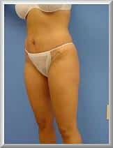 After Image