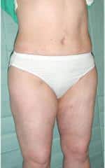 After Image