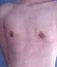 After Image