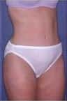 After Image