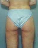 After Image