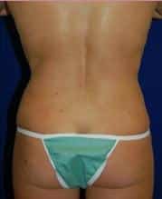 After Image