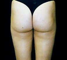 After Image