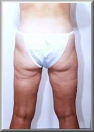 After Image
