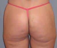 After Image