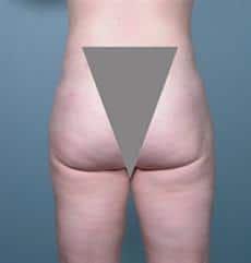 After Image