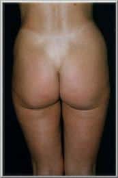 After Image