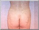 After Image
