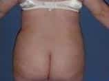 After Image