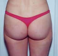 After Image