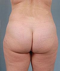 After Image