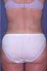 After Image