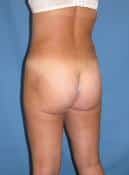 After Image