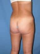After Image