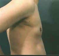 After Image