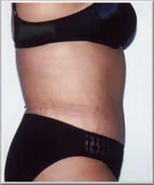 After Image