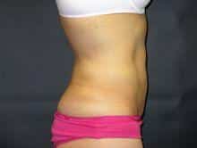 After Image